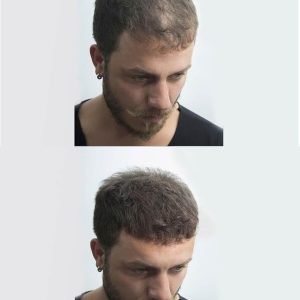 Ürün Görseli 2 Ürün Görseli 2